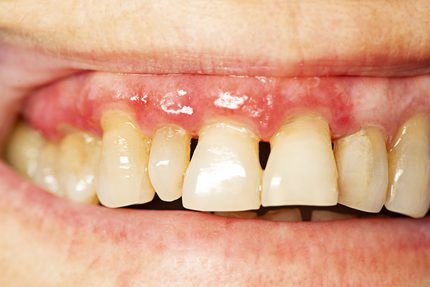 Claves para mantener la sonrisa sana todo el año