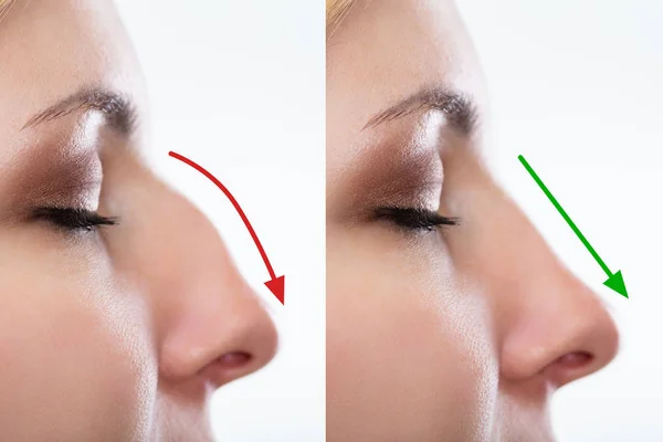 técnicas de cirugía estética