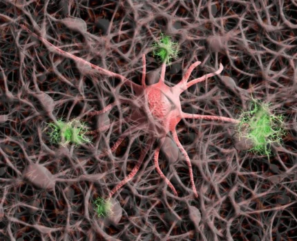 La neurología