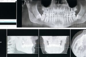 dentista en Santa Cruz de Tenerife