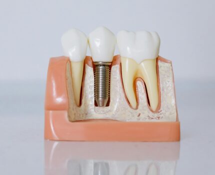 Donde ir a un dentista en Santa Cruz de Tenerife.