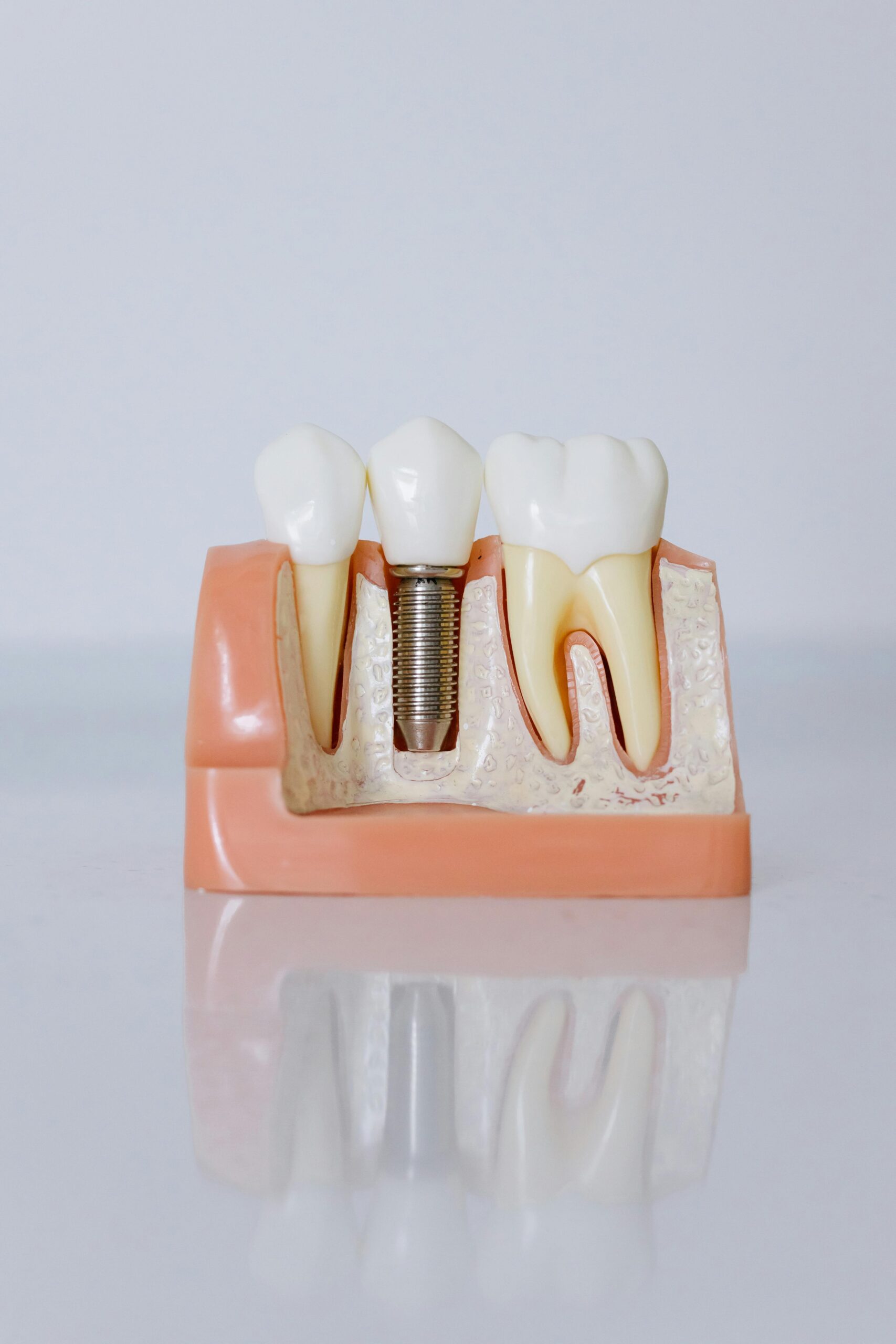 Donde ir a un dentista en Santa Cruz de Tenerife.