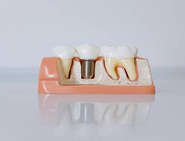 Dental estudio