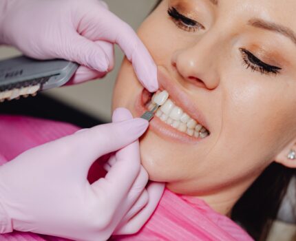 La estética dental: