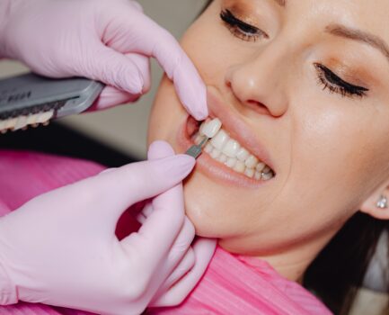 La estética dental: