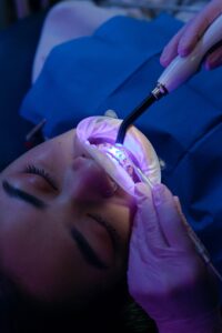 el blanqueamiento dental