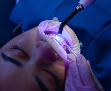 El blanqueamiento dental.