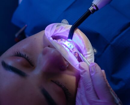 El blanqueamiento dental.